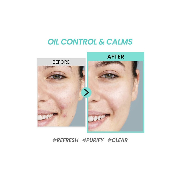 Coxir Tea Tree Pore & Sebum Emulsion 100ML | Bellasoa Paris